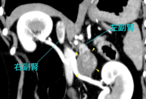 CT基礎知識〜副腎2〜 | 動物検診センター キャミック