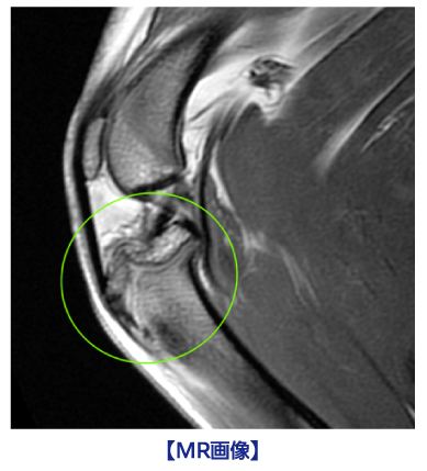 関節のMRI 創業20周年 特別連載コラム〜第2回〜】関節のMRI | 動物検診センター