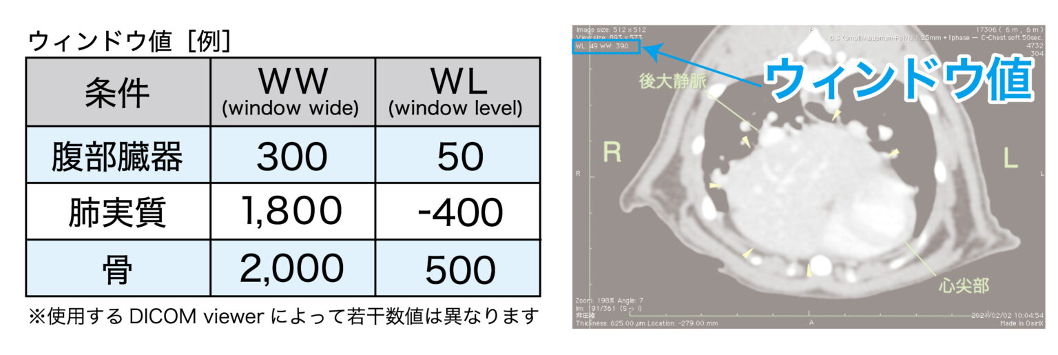 CT基礎知識〜CT値・WW・WL・MPR・MIP〜 | 動物検診センター キャミック